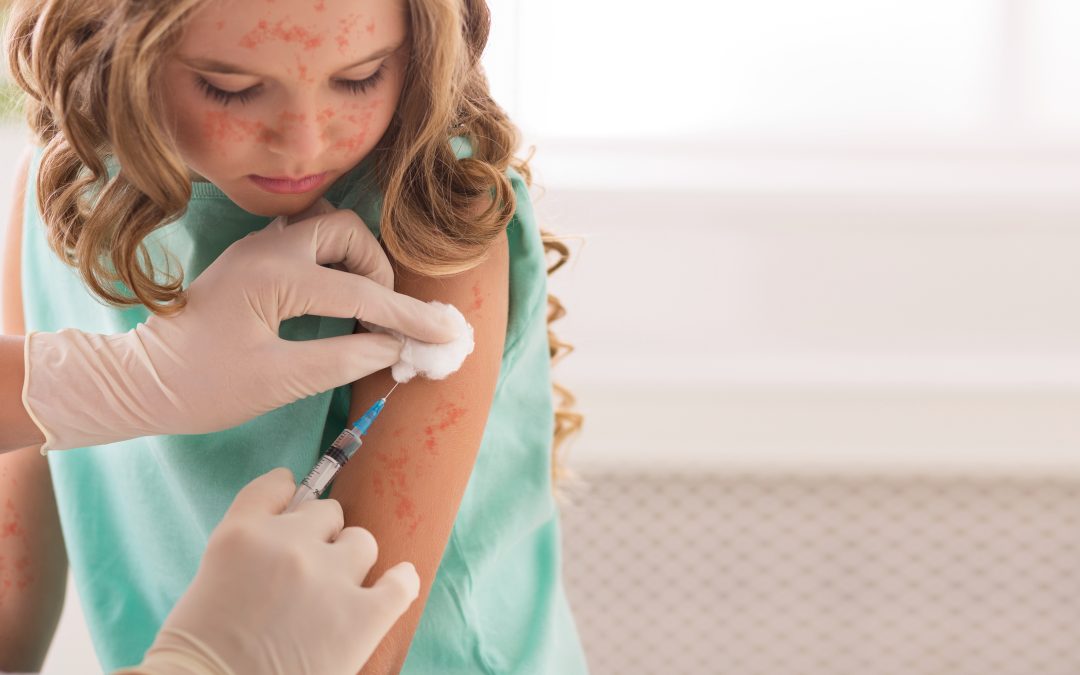 ارتفاع حالات الحصبة في مونتريال و الصحة العامة تحث على التطعيم